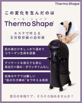 サーモシェイプマシンの特徴